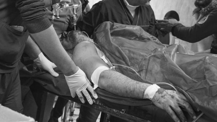 YPG'nin Halep'teki saldırılarında 7 kişi öldü, 52 kişi yaralandı