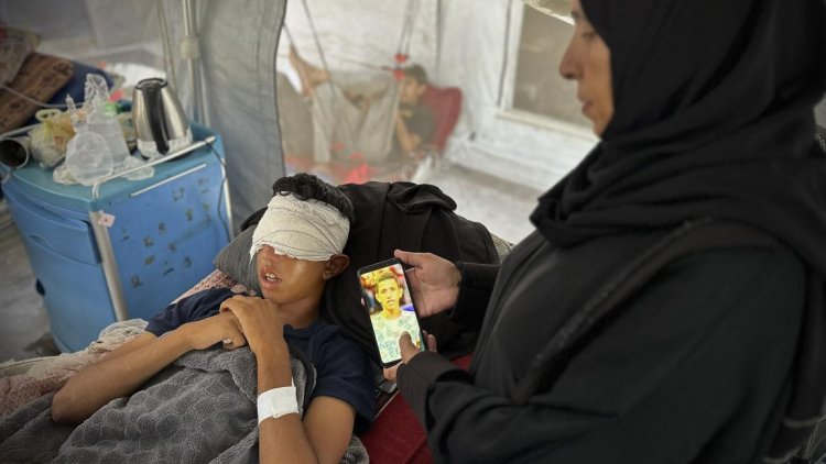 Gazze’ye yönelik savaş sırasında 17 bin kişi gözlerinden yaralandı