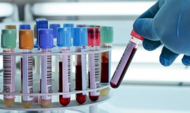 Kansere erken teşhis imkanı kılacak yeni bir kan testi geliştirildi