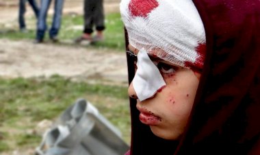 Suriye'deki iç savaşın kaybedenleri: Çocuklar