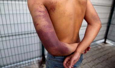 'Yunan askerleri beni tüfekle dövdü'