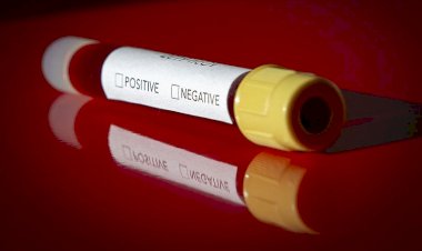 Dünya Sağlık Örgütünün İdlib'de Kovid-19 testi yapması bekleniyor