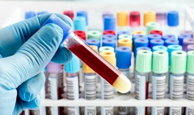 Koronavirüs hangi kan grubunda daha yüksek görülüyor?