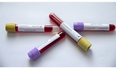 Suudi Arabistan ve Bahreyn'de koronavirüsten can kaybı artıyor